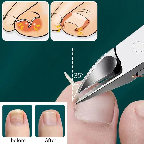 NailCare Pro™ - Nail Cutter
