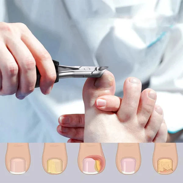 NailCare Pro™ - Nail Cutter